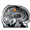 New England Journal of Medicine