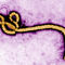 В Шотландии зафиксирован случай заражения Эболой