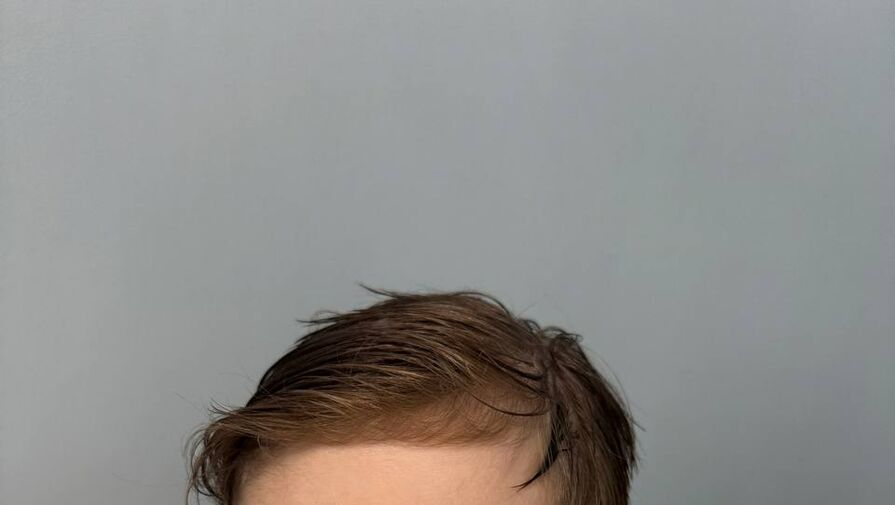 Блогерша Ида Галич опубликовала фото сына во время ветрянки