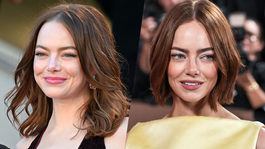 Актриса Эмма Стоун спровоцировала слухи о подтяжке лица из-за выхода на премии