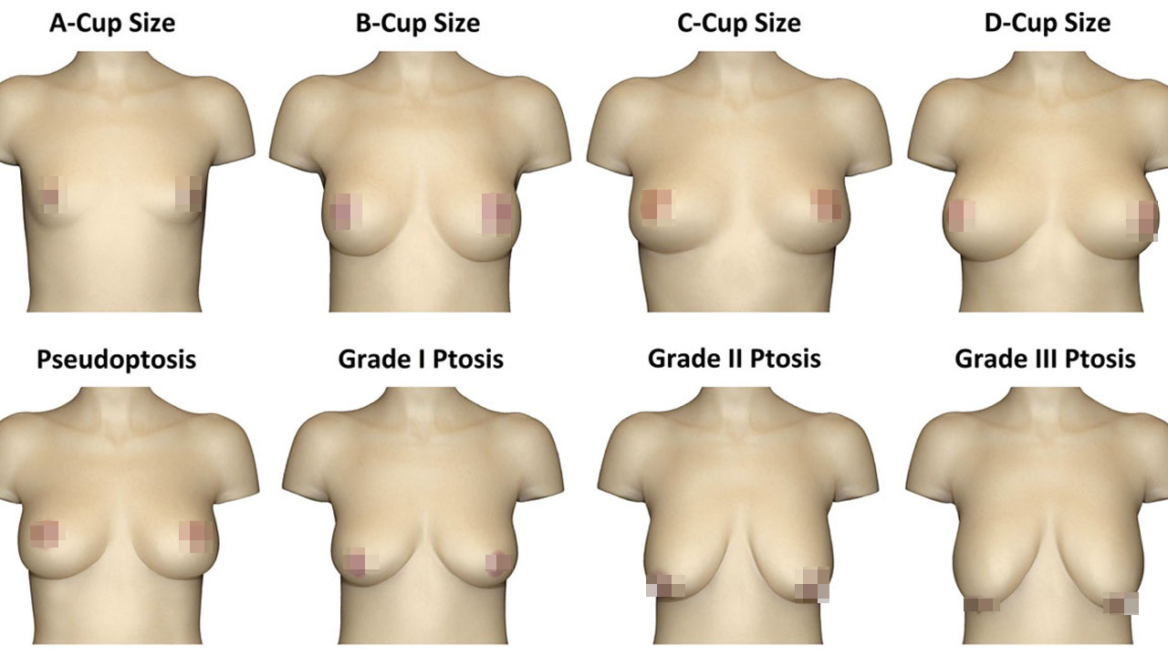 Разные груди у женщин 73 фото - секс фото 