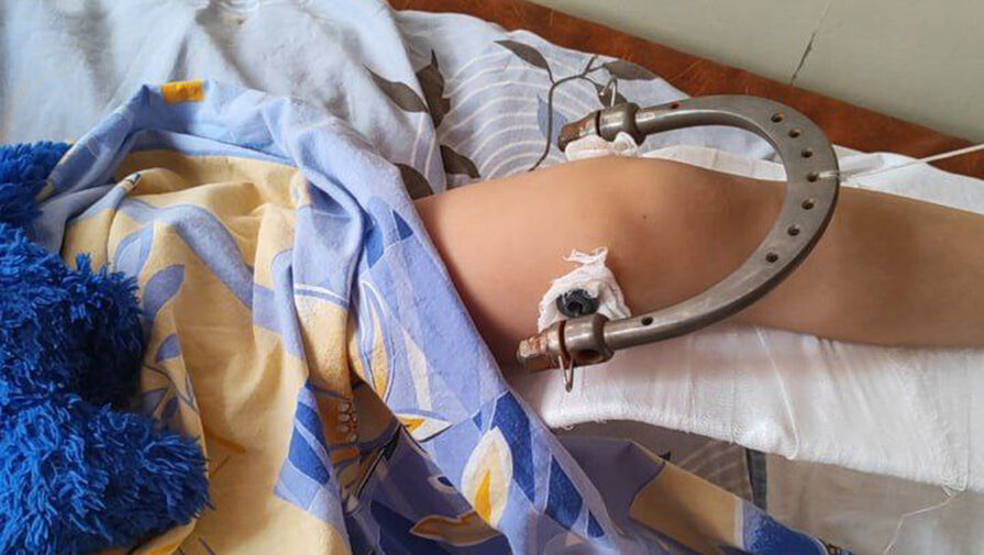 В Бийске ребенок сломал ногу в автобусе 
