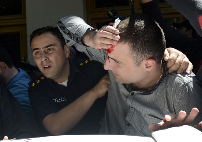 Раненый во время столкновений верующих с&nbsp;ЛГБТ-активистами в&nbsp;Тбилиси