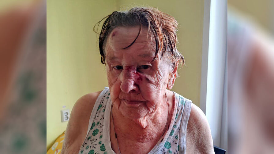 Родственник рассказал, за что в пансионате Красноярска избили 89-летнего ребенка войны