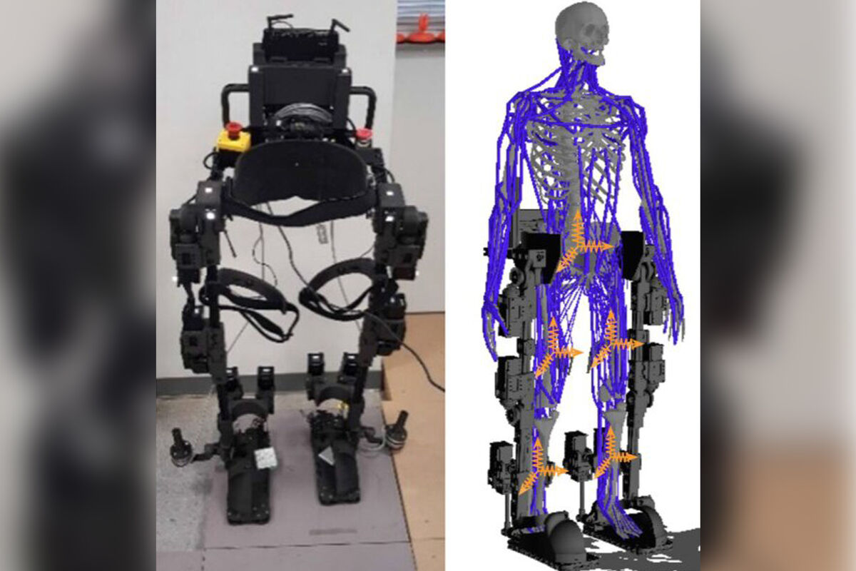 Новая система управления экзоскелетом позволит вернуть подвижность после  инсульта - Газета.Ru | Новости