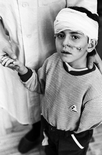 Алла Дарчикян, 7 лет, пострадала от землетрясения, 1988 год