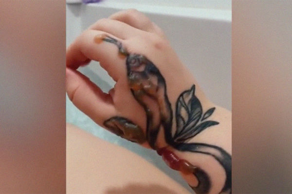 Что делать с прыщами на татуировке