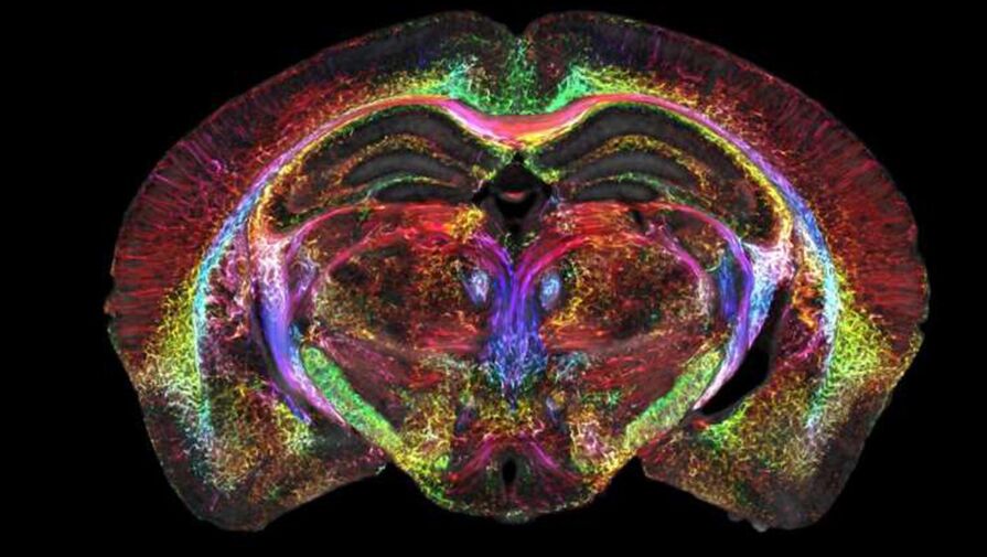 Физики улучшили качество снимков МРТ в 64 миллиона раз и рассмотрели отдельные клетки мозга