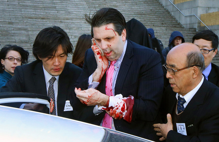 Посол США в&nbsp;Южной Корее Марк Липперт после нападения