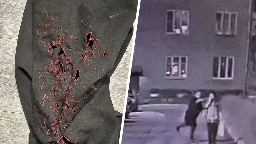 Стали известны подробности нападения мужчины с кислотой на девушек в Подмосковье
