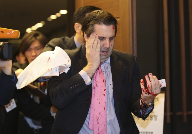 Посол США в&nbsp;Южной Корее Марк Липперт после нападения