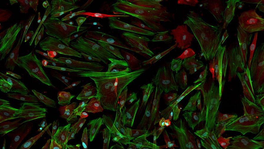 Ученая объяснила, как мозг сам защищает себя от деменции