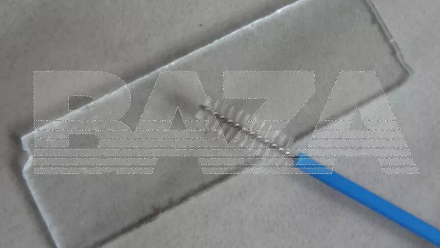 Гинеколог оставила внутри пациентки инструмент, которым делала соскоб