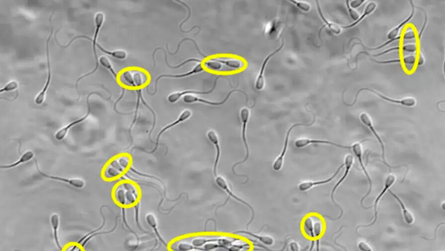 Биологи обнаружили у сперматозоидов необычную способность