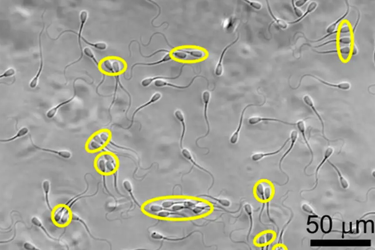 Короткая «жизнь» сперматозоидов