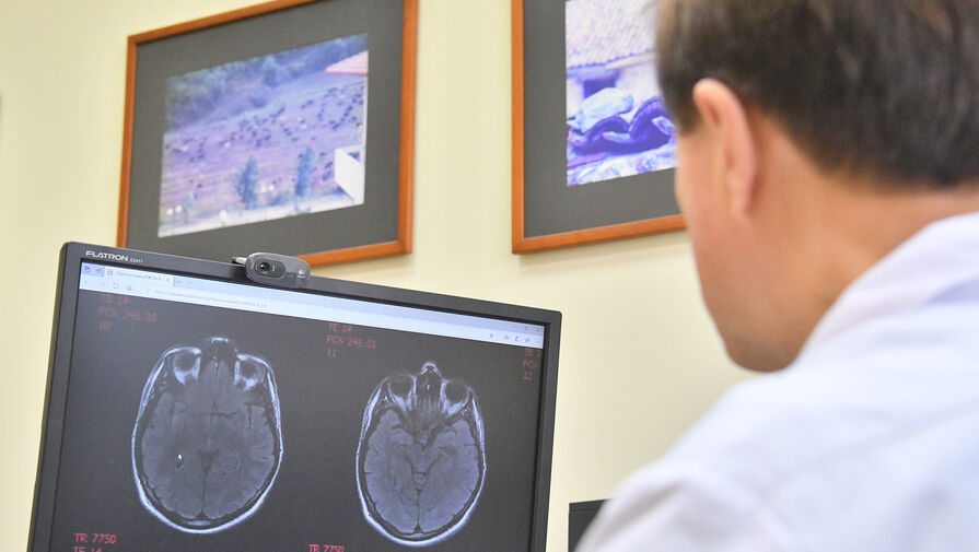 Названа скрытая причина редкого детского инсульта