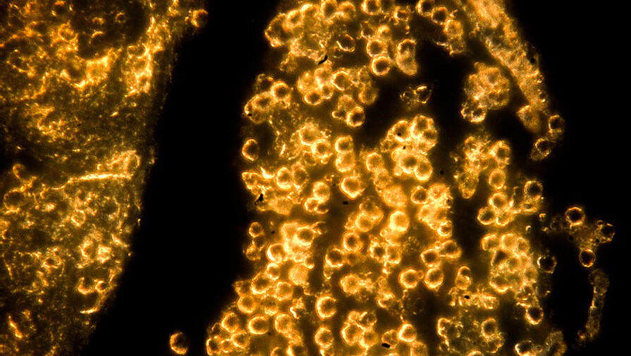 Ученые создали золотую фольгу толщиной в один атом
