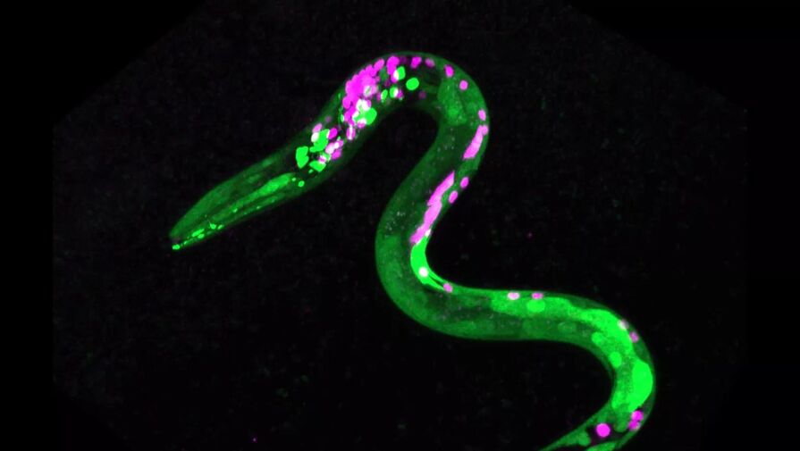 Current Biology: у круглых червей и людей за удовольствие от еды отвечает один механизм