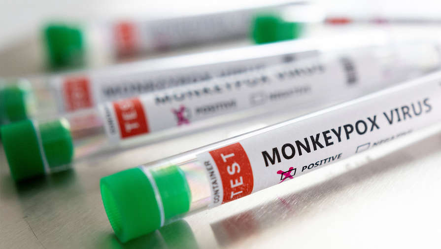 Ученые: COVID-19 и оспой обезьян можно заразиться одновременно