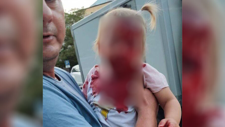 В Крыму родственница олигарха придавила ребенка электросамокатом