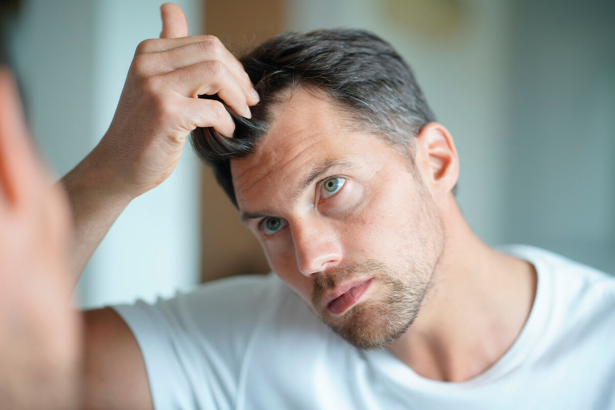 Лечение выпадения волос у мужчин