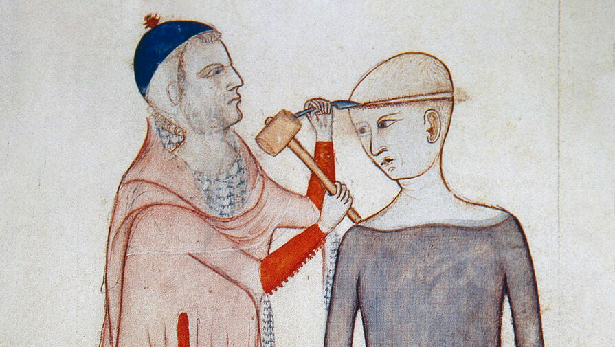 Тест: как проводились медицинские операции в древние времена?