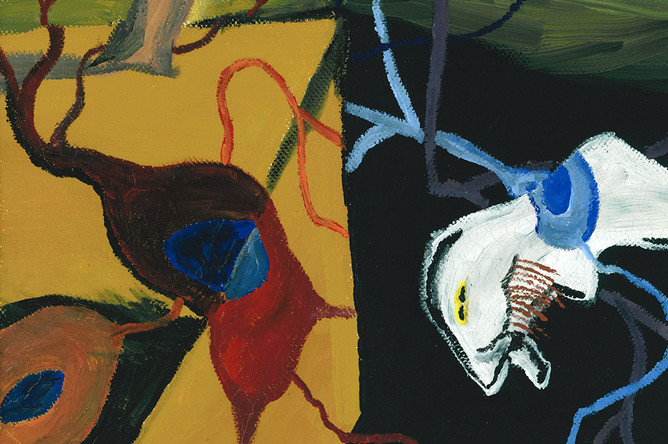 Картина Джейми Эдельсона по мотивам «Постоянства памяти» Сальвадора Дали. Так художник интерпретировал дегенерацию нейронов и потерю памяти при болезни Альцгеймера
