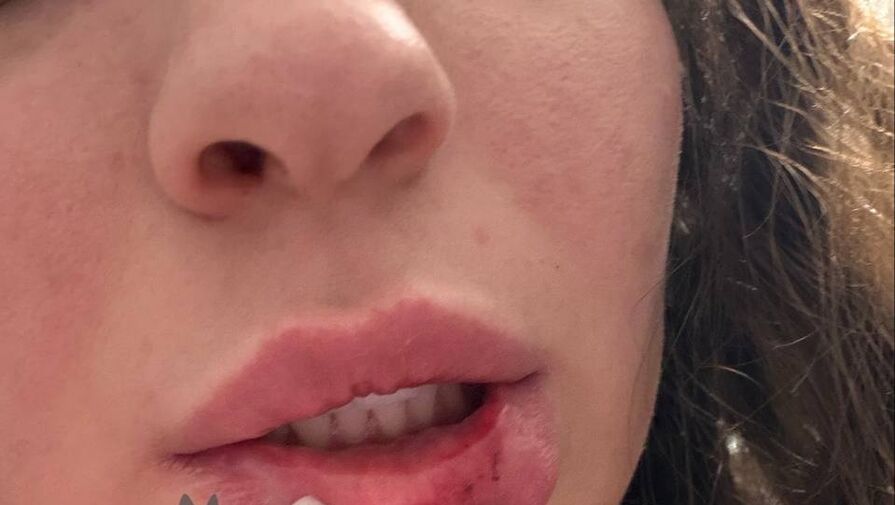 Мужчина назвался бойцом СВО и жестоко избил девушку в баре во Владивостоке