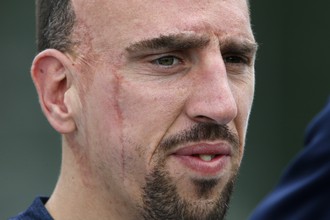 Франк Рибери не сможет помочь «трехцветным» на чемпионате мира по футболу в Бразилии