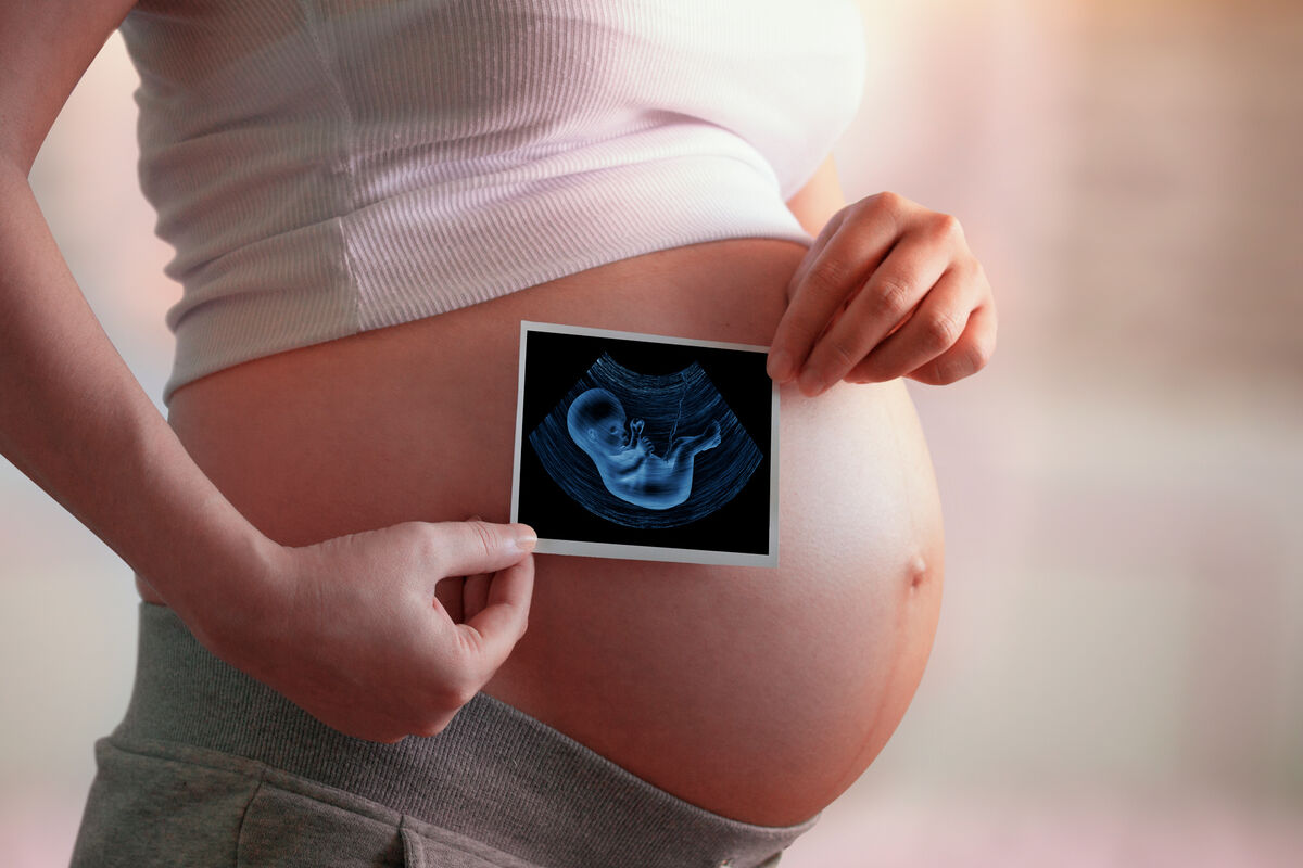32 неделя беременности от зачатия