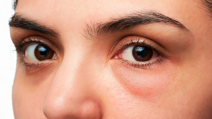 Нейросети научили определять заболевания глаз, приводящие к слепоте