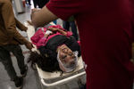 Раненая женщина на носилках в больнице Сринагара, после автобусной аварии, в которой погибли больше 10 человек. Микроавтобус упал в ущелье, 27 июня 2019 года
