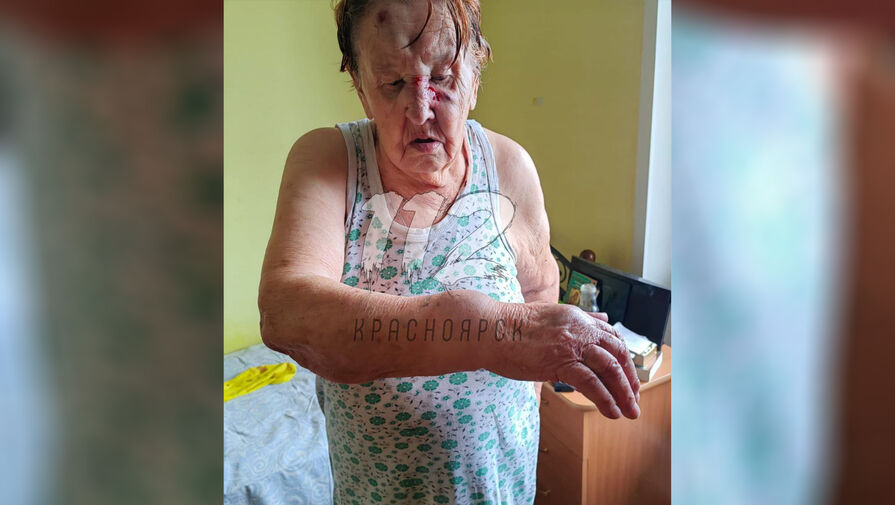 В Красноярске женщина сообщила о том, что ее мать-ветерана избили в пансионате