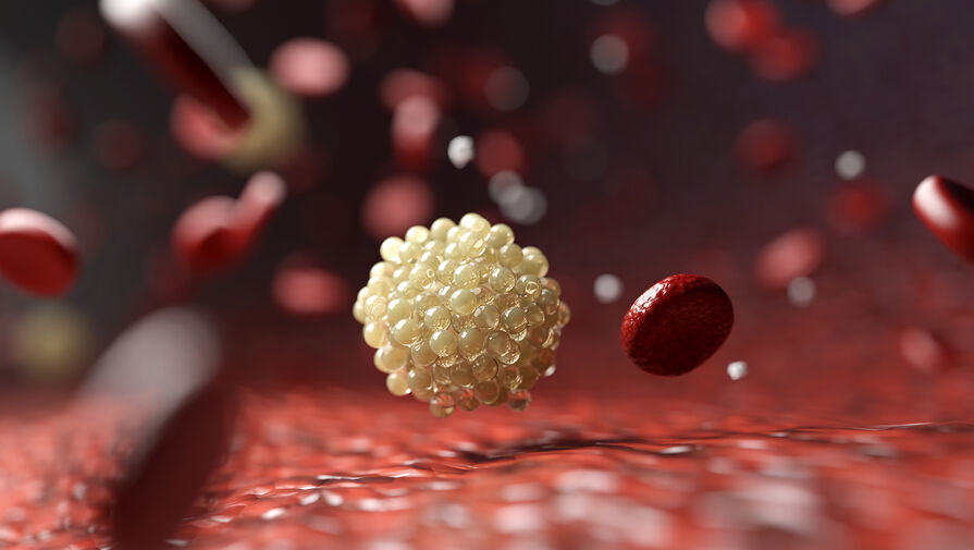 Ученые выяснили, как холестерин стимулирует рост агрессивного рака