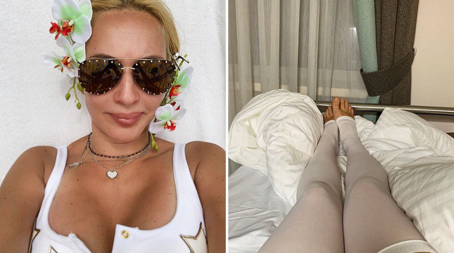 Лера Кудрявцева показала, как выглядит ее грудь после удаления имплантов | STARHIT