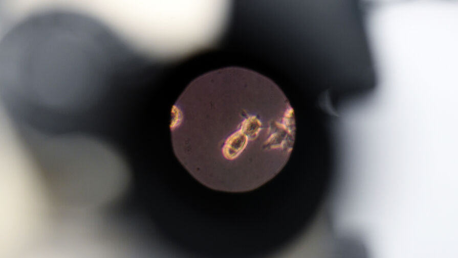 Вирусолог оценил вероятность распространения вируса Нипах в России