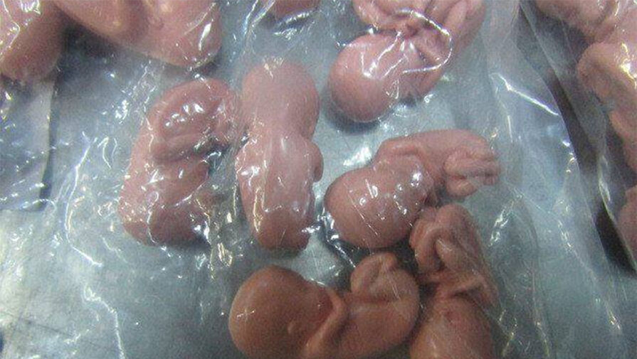 На российской границе задержали партию моделей эмбрионов человека