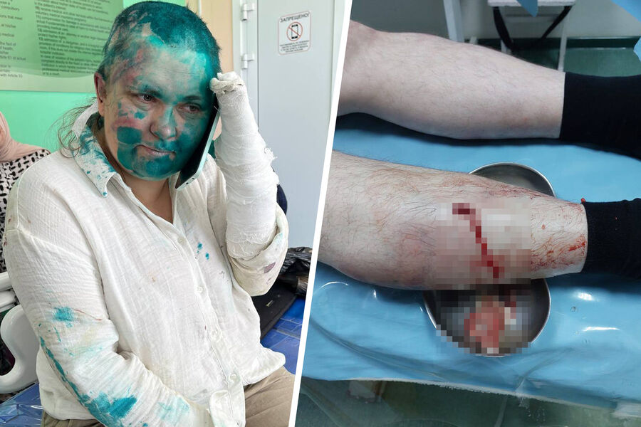 Журналистка Елена Милашина в больнице и поврежденная нога адвоката Александра Немова