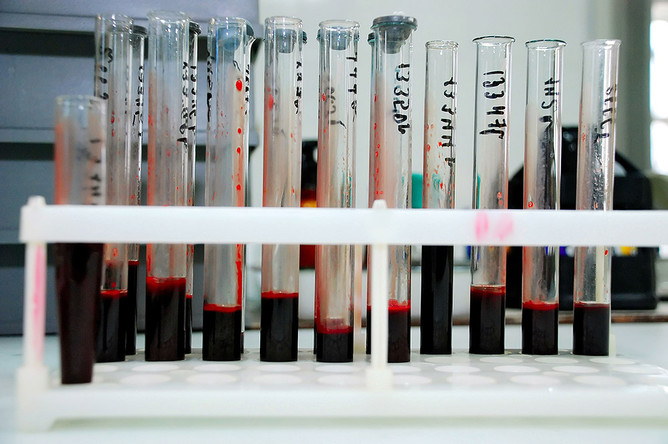 В лаборатории, где исследуют кровь на наличие ВИЧ