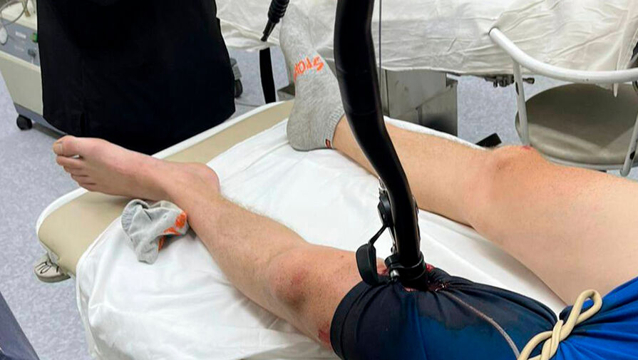 В Хабаровске врачи вытащили руль от велосипеда из ноги пациента