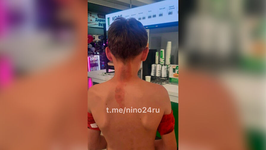 В Нижнем Новгороде охранника магазина, облившего 13-летнего мальчика кипятком, уволили
