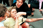 Пострадавшая в результате теракта в подземном переходе под Пушкинской площадью в Москве, 8 августа 2000 года