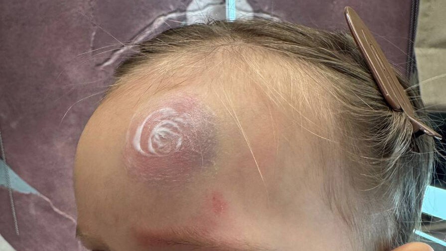 Пятилетняя дочь рэпера ST свалилась со ступеней и ударилась головой