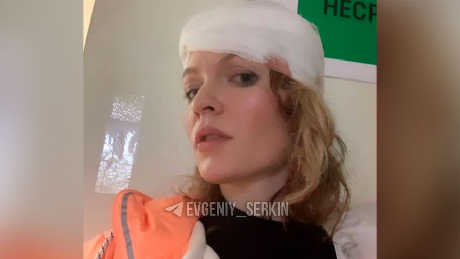 В Калуге актриса повредила челюсть во время спектакля