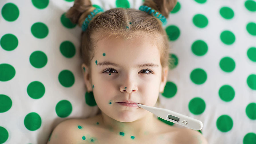 Вакцинация против ветряной оспы входит в национальный календарь прививок thumbnail