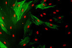 Визуализация белков цитоскелета в стволовых клетках из жировой ткани человека