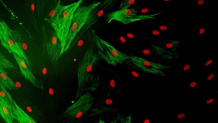 Визуализация белков цитоскелета в&nbsp;стволовых клетках из&nbsp;жировой ткани человека