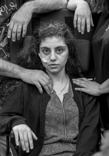 «Пробуждение». 1-е место в категории «Портрет». 15-летняя Ева пострадавшая в результате вынужденного переселения сидит в инвалидной коляске в окружении родителей, в центре приема беженцев в Подкова-Лесьна, Польша. Июнь, 2019.
