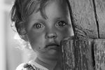 Ребенок из деревни Чудяны (Белоруссия), пораженной радиацией в результате аварии на Чернобыльской АЭС