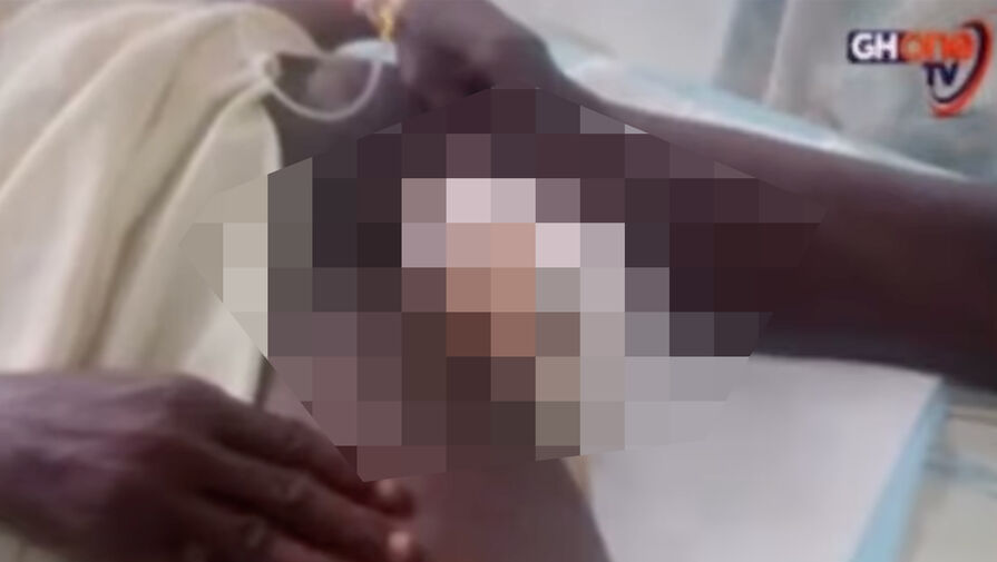 В Гане 47-летний мужчина во сне отрезал себе гениталии, думая, что забивает козу для жены